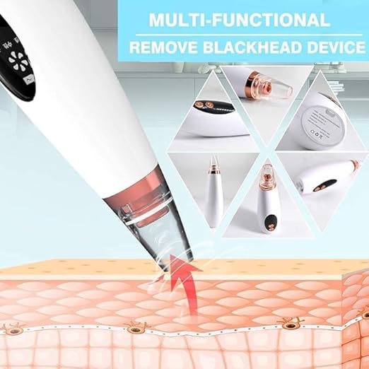 Blackhead and whitehead remover tool pack with attachments